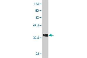 Western Blot detection against Immunogen (36. (Recoverin anticorps  (AA 101-199))