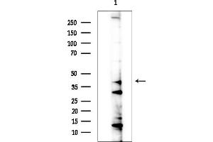 anti-Carbohydrate (Chondroitin 6) Sulfotransferase 3 (CHST3) (C-Term) antibody