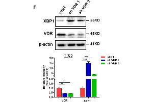 Calcipotriol inhibits NLRP3 by activating yes-associated protein 1 (YAP1).