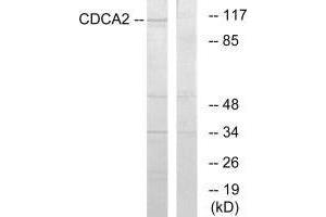 Western blot analysis of extracts from 293 cells, using CDCA2 antibody. (CDCA2 anticorps  (C-Term))