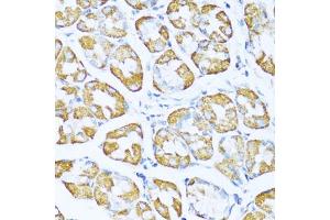 Immunohistochemistry of paraffin-embedded human stomach using NDUF antibody (ABIN7268804) at dilution of 1:100 (40x lens).