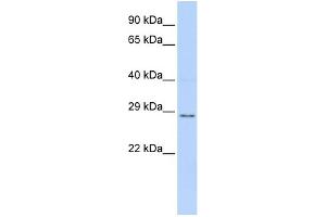 WB Suggested Anti-TFPI2 Antibody Titration: 0. (TFPI2 anticorps  (Middle Region))