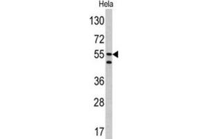 Western Blotting (WB) image for anti-Carbonic Anhydrase IX (CA9) antibody (ABIN3002202)
