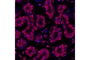Immunofluorescence (IF) image for anti-gamma Histone Variant H2AX (GAMMA-H2AX) (Ser140) antibody (ABIN7454026) (Recombinant gamma H2AX anticorps  (Ser140))