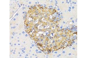 Immunohistochemistry of paraffin-embedded Rat pancreatic islet using INS Polyclonal Antibody at dilution of 1:50 (40x lens). (Insulin anticorps)