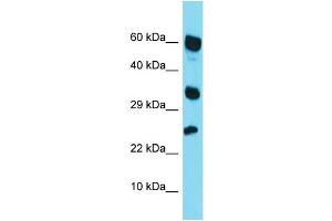 Western Blotting (WB) image for anti-Retinoic Acid Receptor Responder (Tazarotene Induced) 1 (RARRES1) (Middle Region) antibody (ABIN2788899) (RARRES1 anticorps  (Middle Region))