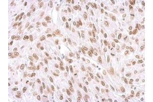 IHC-P Image Lamin A + C antibody detects Lamin A + C protein at membrane on U87 xenograft by immunohistochemical analysis. (Lamin A/C anticorps)