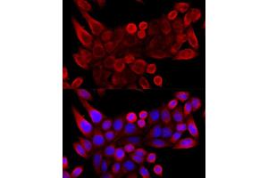 Immunofluorescence analysis of HeLa cells using VD antibody (ABIN6130775, ABIN6150077, ABIN6150078 and ABIN6214830) at dilution of 1:100 (40x lens).