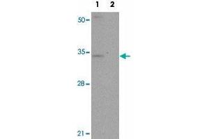 Western blot analysis of SLC39A3 in mouse lung tissue lysate with SLC39A3 polyclonal antibody  at 1 ug/mL in (1) the absence and (2) the presence of blocking peptide. (SLC39A3 anticorps  (Internal Region))