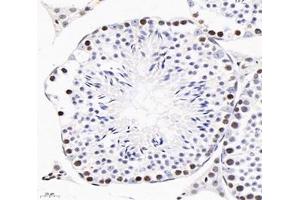 Immunohistochemistry analysis of paraffin-embedded mouse testis using,GINS2 (ABIN7074041) at dilution of 1: 3000 (GINS2 anticorps)
