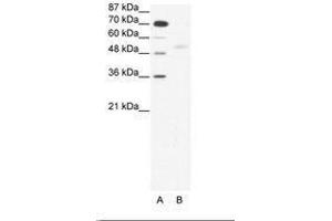 Image no. 1 for anti-SMAD, Mothers Against DPP Homolog 5 (SMAD5) (AA 193-242) antibody (ABIN203157) (SMAD5 anticorps  (AA 193-242))