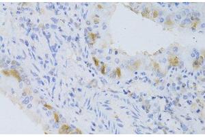 Immunohistochemistry of paraffin-embedded Mouse lung using CYP2C9 Polyclonal Antibody at dilution of 1:100 (40x lens). (CYP2C9 anticorps)