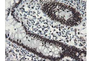 anti-Transducin-Like Enhancer of Split 1 (E(sp1) Homolog, Drosophila) (TLE1) (AA 180-460) antibody