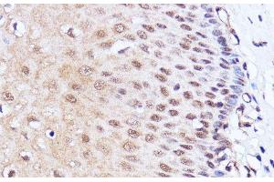 Immunohistochemistry of paraffin-embedded Human esophageal using BRD4 Polyclonal Antibody at dilution of 1:100 (40x lens).