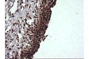 Image no. 4 for anti-Von Hippel-Lindau Tumor Suppressor, E3 Ubiquitin Protein Ligase (VHL) antibody (ABIN1501712)