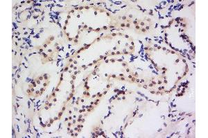 Formalin-fixed and paraffin embedded human kidney labeled with Anti-Dymeclin Polyclonal Antibody, Unconjugated  at 1:200 followed by conjugation to the secondary antibody and DAB staining. (Dymeclin anticorps  (AA 151-250))
