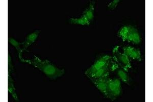 Immunofluorescent analysis of Hela cells using ABIN7161975 at dilution of 1:100 and Alexa Fluor 488-congugated AffiniPure Goat Anti-Rabbit IgG(H+L) (NOL4L (AA 101-300) anticorps)