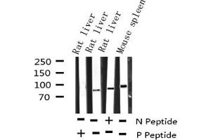 Western blot analysis of Phospho-STAT5A (Tyr694) expression in various lysates