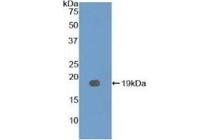 Detection of Recombinant IL12Rb2, Mouse using Polyclonal Antibody to Interleukin 12 Receptor Beta 2 (IL12Rb2) (IL12RB2 anticorps  (AA 285-441))