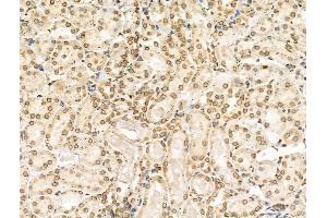 ABIN6257023 and ABIN6274557 at 1/100 staining Rat kidney tissue by IHC-P. (DYRK1B anticorps  (Internal Region))