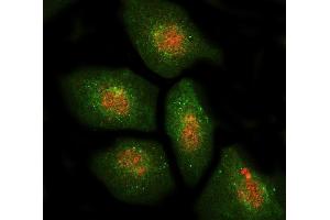 IF analysis of DBF4 using anti-DBF4 antibody (ABIN7601162) and anti-Beta Tubulin antibody (ABIN7602743). (DBF4 anticorps  (AA 295-665))