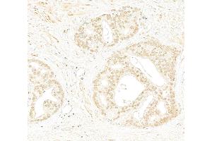 Immunohistochemistry (IHC) image for anti-RAD9 Homolog A (S. Pombe) (RAD9A) (C-Term) antibody (ABIN7454682)
