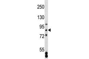 SATB2 antibody western blot analysis in MCF-7 lysate (SATB2 anticorps  (AA 410-439))