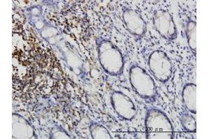Image no. 2 for anti-C-Src tyrosine Kinase (CSK) (AA 1-101) antibody (ABIN598630) (CSK anticorps  (AA 1-101))
