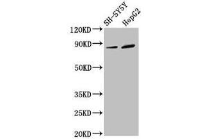 Western Blot Positive WB detected in: SH-SY5Y whole cell lysate, HepG2 whole cell lysate All lanes: DPY19L3 antibody at 3. (DPY19L3 anticorps  (AA 587-697))