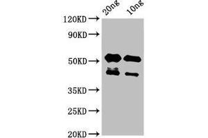 Western Blot Positive WB detected in Recombinant protein All lanes: lats2 antibody at 3 μg/mL Secondary Goat polyclonal to rabbit IgG at 1/50000 dilution Predicted band size: 43 kDa Observed band size: 43, 53 kDa (LATS2 anticorps  (AA 1022-1140))