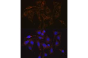 Immunofluorescence analysis of U-2 OS cells using V Rabbit mAb (ABIN7271312) at dilution of 1:100 (40x lens). (VAMP1 anticorps)