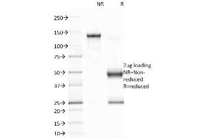 SDS-PAGE Analysis Purified EBV Mouse Monoclonal Antibody (CS1). (EBV LMP1 anticorps)