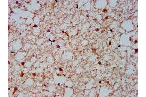 IHC image of ABIN7161538 diluted at 1:600 and staining in paraffin-embedded human brain tissue performed on a Leica BondTM system. (NFKBIL1 anticorps  (AA 185-312))
