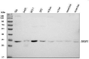 Western blot analysis of SF2/SRSF1 using anti-SF2/SRSF1 antibody (ABIN3043296). (SRSF1 anticorps  (N-Term))