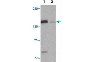 Western blot analysis of N4BP1 in HeLa cell lysate with N4BP1 polyclonal antibody  at 0. (N4BP1 anticorps  (N-Term))