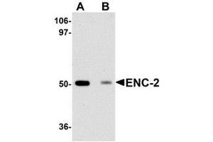 Western blot analysis of ENC-2 in Jurkat cell lysate with AP30315PU-N ENC-2 antibody at 1 μg/ml in (A) the absence and (B) the presence of blocking peptide. (KLHL25 anticorps  (Center))