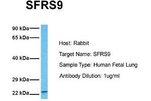 Host: Rabbit Target Name: SFRS9 Sample Tissue: Human Fetal Lung Antibody Dilution: 1.