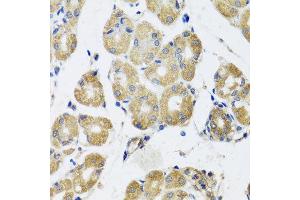 Immunohistochemistry of paraffin-embedded human gastric using RAD51C antibody at dilution of 1:100 (x40 lens). (RAD51C anticorps)
