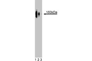 Western blot analysis of delta-Catenin on a rat cerebrum lysate. (CTNND2 anticorps  (AA 85-194))