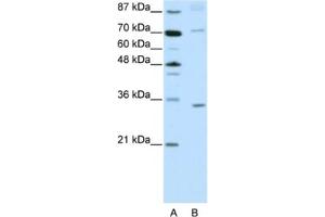 Western Blotting (WB) image for anti-Atonal Homolog 8 (ATOH8) antibody (ABIN2461959) (ATOH8 anticorps)