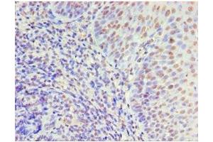 Immunohistochemistry of paraffin-embedded human tonsil tissue using ABIN7150338 at dilution of 1:100 (MCM5 anticorps  (AA 1-230))