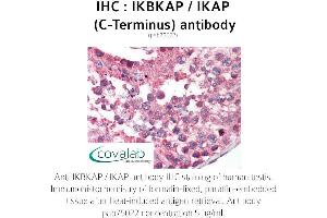 Image no. 1 for anti-Elongator Complex Protein 1 (ELP1) antibody (ABIN1735852) (IKAP/p150 anticorps)