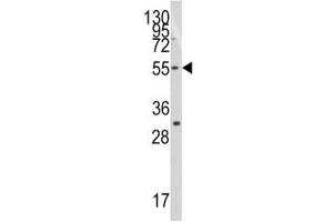Western blot analysis of TRF1 antibody and Jurkat lysate