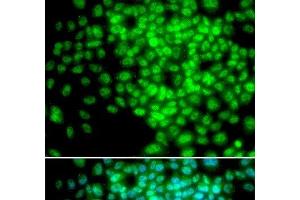 Immunofluorescence analysis of HeLa cells using POLR2F Polyclonal Antibody (POLR2F anticorps)