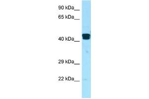 WB Suggested Anti-LIMS1 Antibody Titration: 1. (LIMS1 anticorps  (Middle Region))