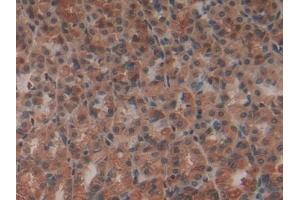 Detection of MMP12 in Rat Stomach Tissue using Polyclonal Antibody to Matrix Metalloproteinase 12 (MMP12)