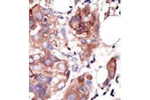 Image no. 2 for anti-Muscle, Skeletal, Receptor Tyrosine Kinase (MUSK) (C-Term) antibody (ABIN359903) (MUSK anticorps  (C-Term))