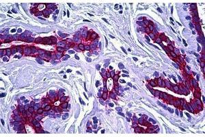 Human Breast: Formalin-Fixed, Paraffin-Embedded (FFPE) (Keratin 8/18/19 anticorps)