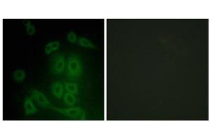 Immunofluorescence analysis of A549 cells, using FXR2 antibody. (FXR2 anticorps  (C-Term))