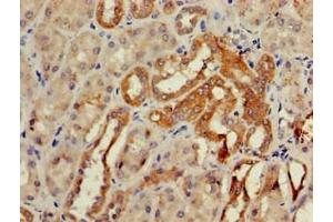 Immunohistochemistry of paraffin-embedded human kidney tissue using ABIN7147659 at dilution of 1:100 (GCM2 anticorps  (AA 156-451))